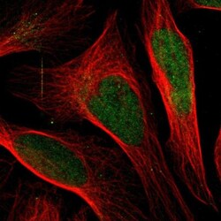 DHPS Antibody, Novus Biologicals 0.1mL; Unlabeled:Antibodies, Polyclonal